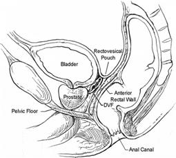 Sagittal view of the rectum