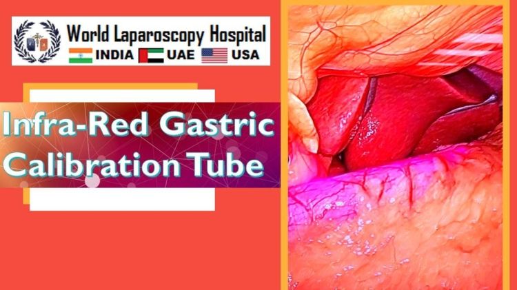 Infra-Red Gastric Calibration Tube