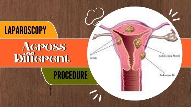 Laparoscopy Across Different Surgical Procedures