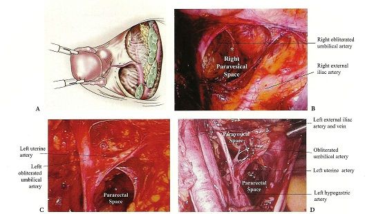 Anatomy of Female Pelvis