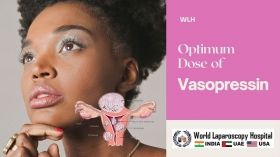 Dosis óptima de vasopresina en miomectomía laparoscópica para fibromas uterinos