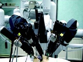 Disección de ganglios linfáticos pélvicos mediante prostatectomía robótica