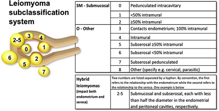 Classification of Myoma