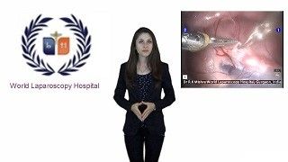 Laparoscopic Cholecystectomy Full HD Video