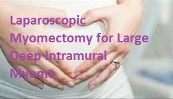 Laparoscopic Myomectomy for Large Intramural Myoma