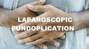 Laparoscopic Weston Knot demonstration by Dr R K Mishra