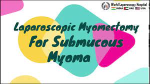 Laparoscopic Removal of Large Grade II Submucous Myoma