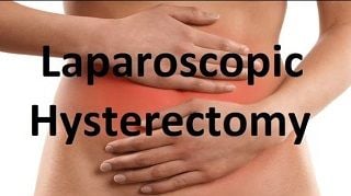 Total Laparoscopic Hysterectomy + BSO using Fluorescence imaging of Ureter and Uterine Artery.
