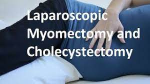 Cholecystectomy for Mucocele of Gallbladder
