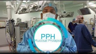 Procedure for prolapse and hemorrhoids (PPH)