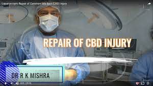 Laparoscopic Repair of Common bile duct (CBD) injury