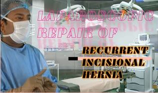 Laparoscopic Repair of Inguinal Hernia Lecture - Dr. R. K. Mishra