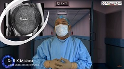 First in the World 3.5 Kg Fibroid, Ovarian Cyst, Gallbladder & Appendix removed by Laparoscopy