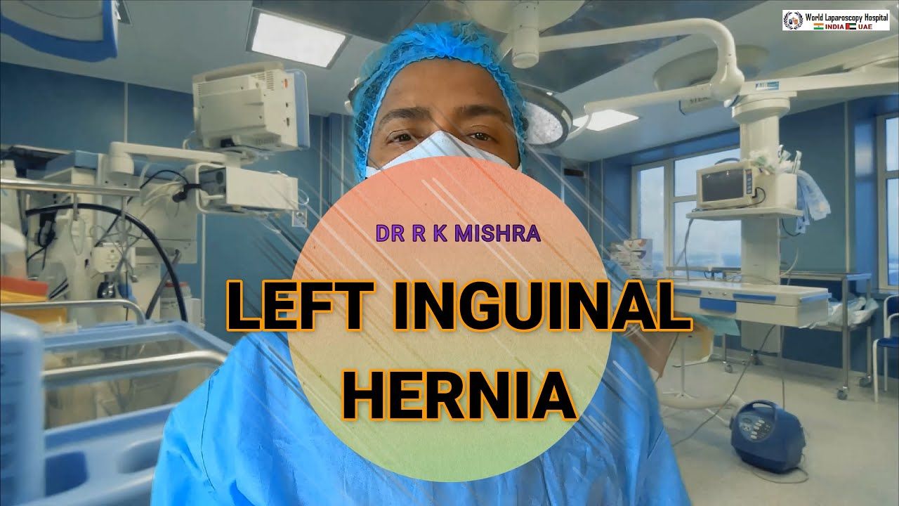 IPOM Umbilical Hernia Repair by VIPRO II Mesh
