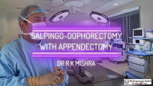 Salpingo Oophorectomy with Appendectomy and Extraction Through Colpotomy