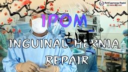 Laparoscopic inguinal hernia repair "IPOM" with Dual-Mesh