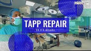 Easiest Way of Performing Laparoscopic Inguinal Hernia Repair Using Less Expensive Mesh