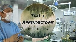 Laparoscopic Hysterectomy By Ligation of Uterine Artery and Simultaneous Appendectomy