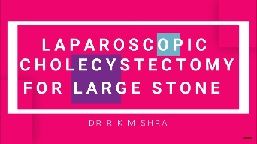 Urological Laparoscopy at World Laparoscopy Hospital