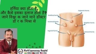 Laparoscopic Cholecystectomy for Stump Cholecystitis