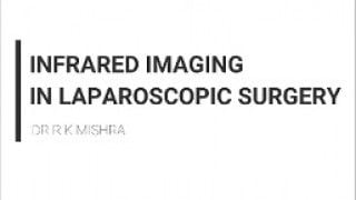 Use of Infrared Imaging Technique in Laparoscopic Surgery