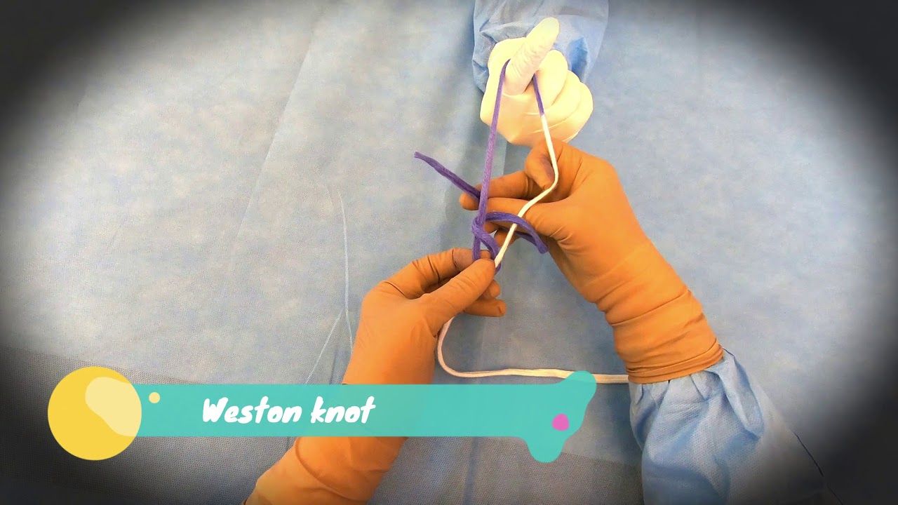 Laparoscopic Weston Knot