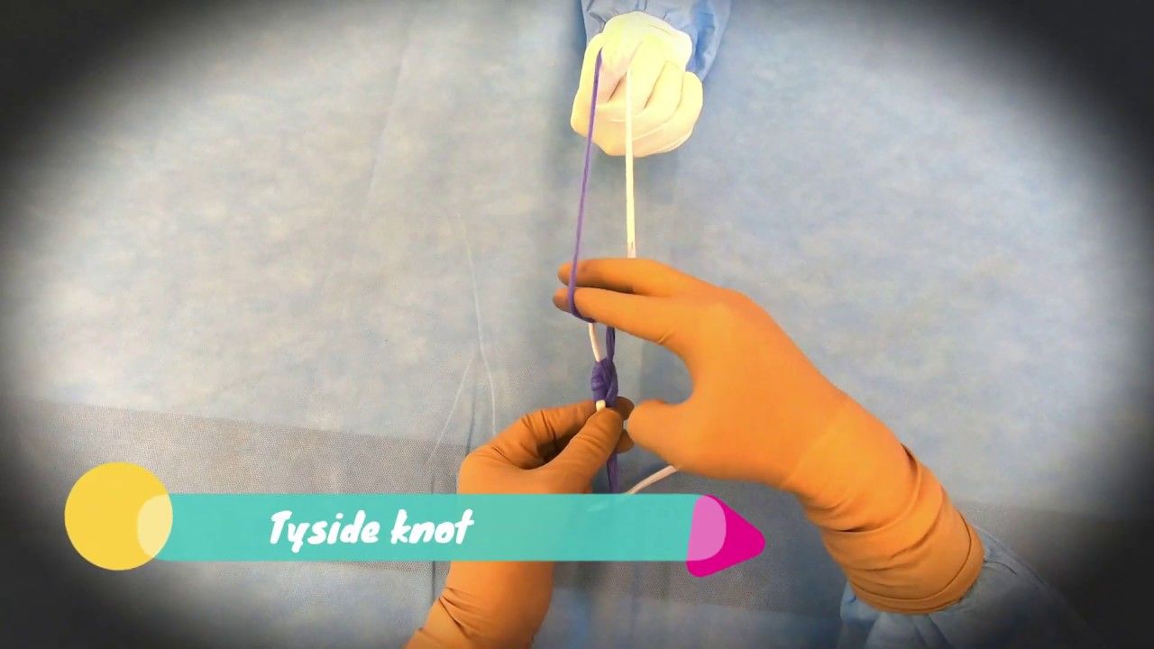 Laparoscopic Tayside Knot