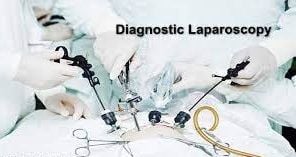 Laparoscopic Surgery for Dermoid Ovarian Cyst