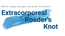 Step-by-step demonstration of laparoscopic hysterectomy and appendectomy illuminated ureteral stent