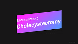 Standard Laparoscopic Cholecystectomy