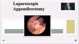 Extracorporeal Knot For Laparoscopic Appendicectomy