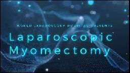 Total Laparoscopic Hysterectomy by Dr R K Mishra