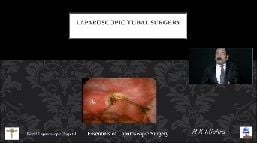 Total Laparoscopy Hysterectomy Lecture by Dr R K Mishra