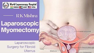 Laparoscopic Dermoid Ovarian Cystectomy by Dr R K Mishra