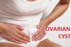 What is Ovarian Cyst and How it is Managed By Laparoscopy