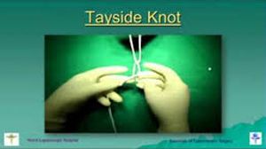 Laparoscopic Tayside Knot demonstration by Dr R K Mishra