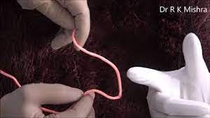 Laparoscopic Extracorporeal Square Knot demonstration by Dr R K Mishra