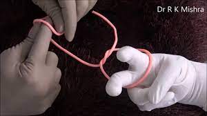 Laparoscopic Tumble Square Knot demonstration by Dr R K Mishra