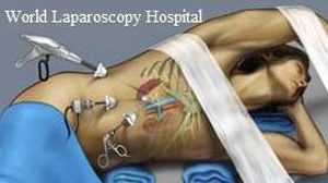 What is the difference in laparoscopic and robotic surgery?
