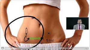 Lecture on Laparoscopic Appendectomy for Acute Appendicitis