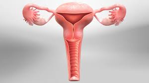 Endometrioma Surgery by Laparoscopy