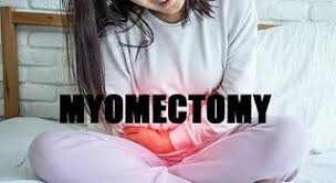 Laparoscopic Repair of Subcostal Incisional Hernia