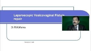 Vesicovaginal Fistula Repair VVF - Lecture by Dr R K Mishra
