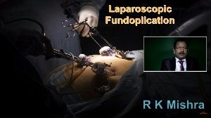 Laparoscopic Weston Knot demonstration by Dr R K Mishra