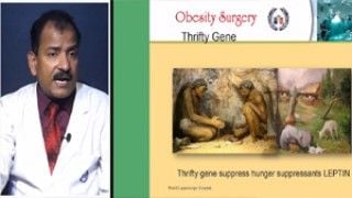Sleeve Gastrectomy Fully Explained by Dr R K Mishra