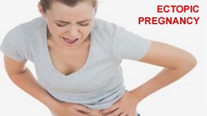 Laparoscopic Management of Ruptured Ectopic Pregnancy