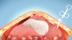 International Patients at World Laparoscopy Hospital