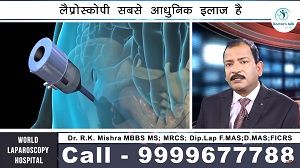 IPOM Umbilical Hernia Repair by VIPRO II Mesh