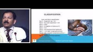 Diagnostic Laparoscopy Lecture by Dr R K Mishra