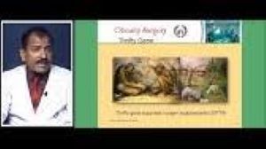Robotic Surgery - Past Present and Future of Robotic Surgery - Lecture by Dr R K Mishra
